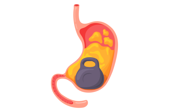 Heavy Stomach Syndrome Graphics and Illustrations