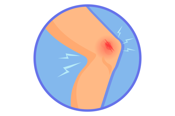 Knee Injury Wound: Medical Graphics & Illustrations